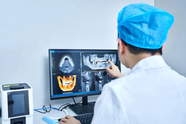Best Emergency Root Canal Treatment in Tracy, CA